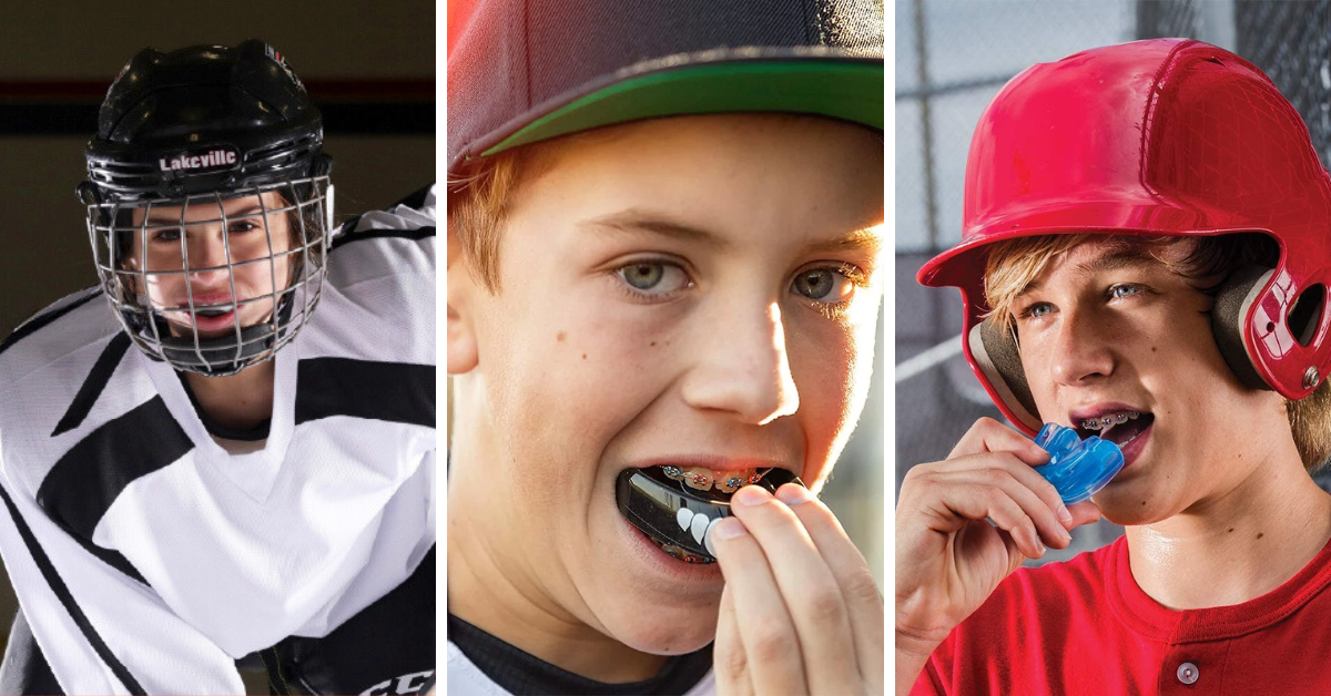 Smile Safe With Our 5 Five Picks Of Mouth Guards For Braces!