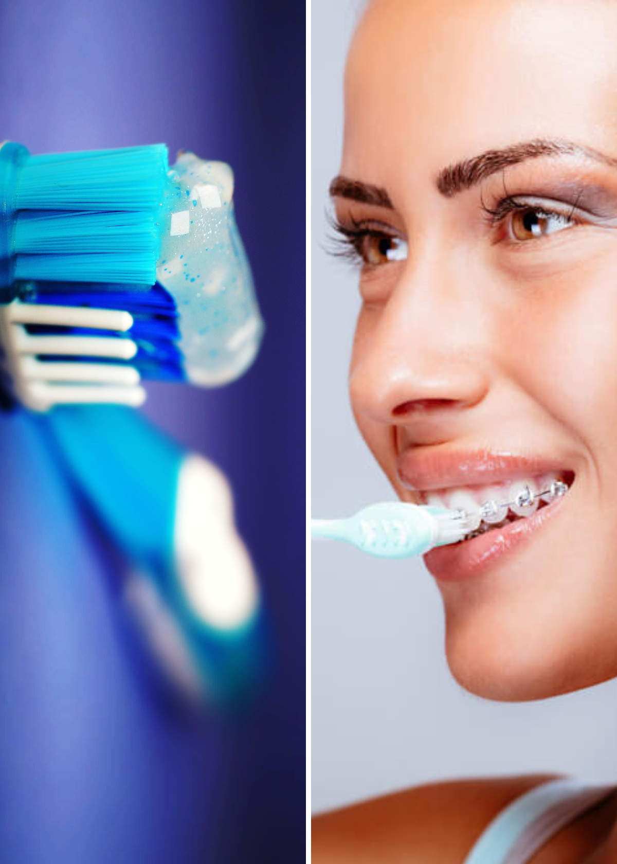 The BracesFriendly Toothpaste We Can't Live Without